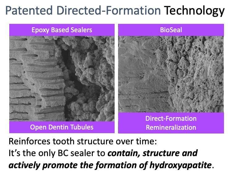 Patented Direct Formation Technology
